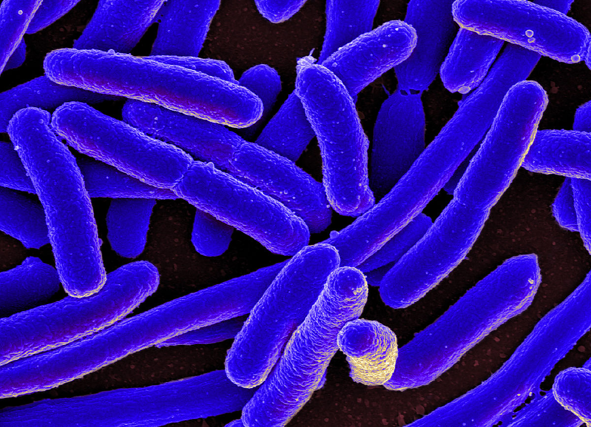 Bacteria e coli. Imagen de NIAID