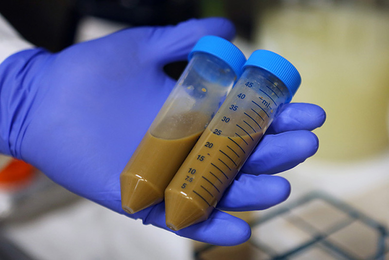 University of Minnesota post doctorate fellow Matt Hamilton displays a sample of fecal bacteria at the St. Paul, Minn. campus Nov. 14, 2012. The fecal matter is donated and used to treat patients with Clostridium difficile, an intestinal disease that is caused when a person's gut flora is eliminated by antibiotics.
