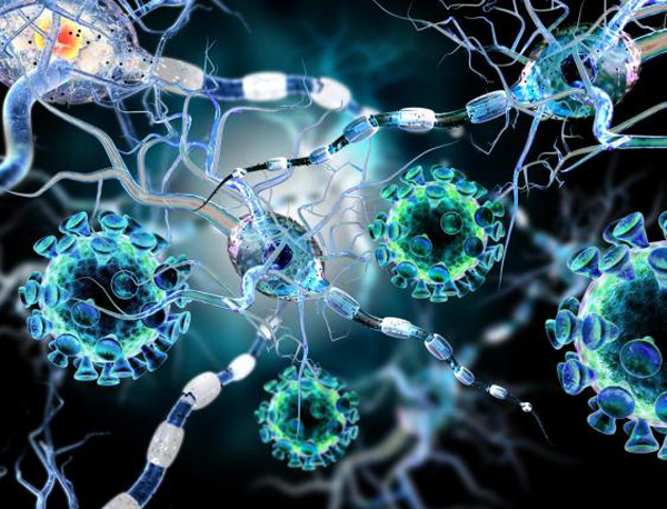 New-therapy-could-halt-multiple-sclerosis-progress